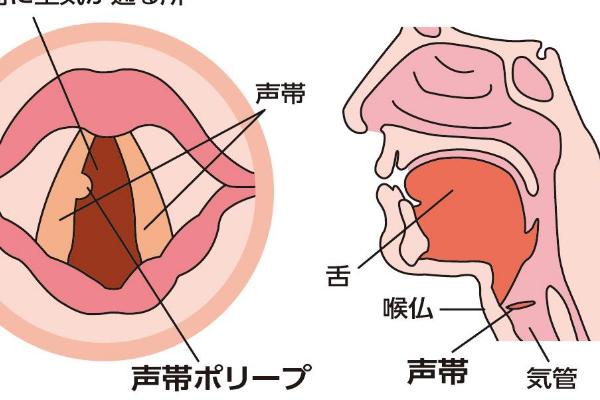 如何知道自己声带坏了，一张口就觉得喉咙疼痛难忍