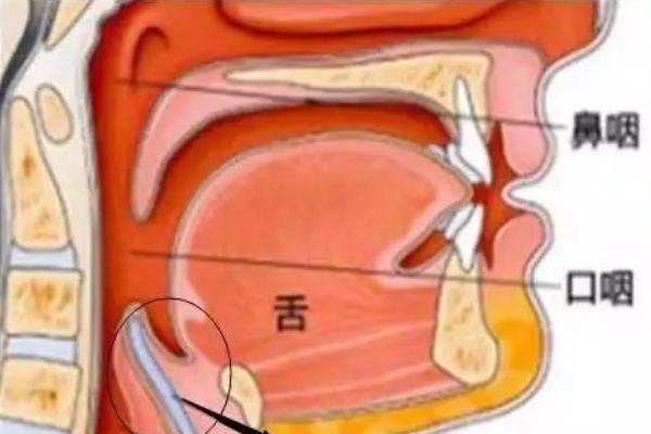 嗓子老是压着放不开怎么办，首先保持放松状态