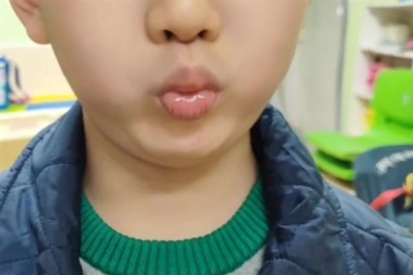口部操主要锻炼什么，主要锻炼口部的口腔状态