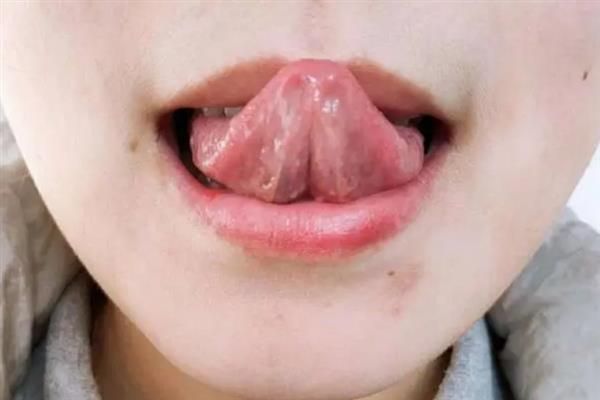 如何控制说话的节奏，可以多关注别人听自己话时的感受