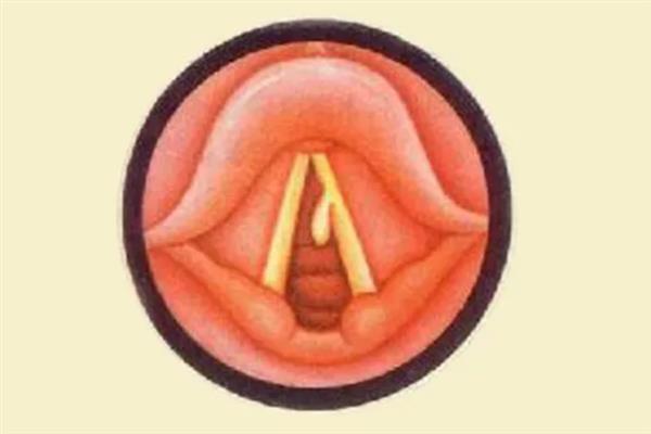 判断播音时是用气息还是喉咙的方法，用气息发音比较扎实且有力量感