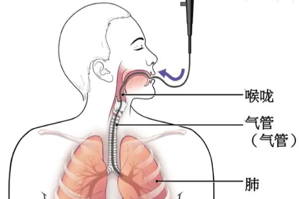 如何运用共鸣发出伪音，为避免泄露气息需闭合鼻咽